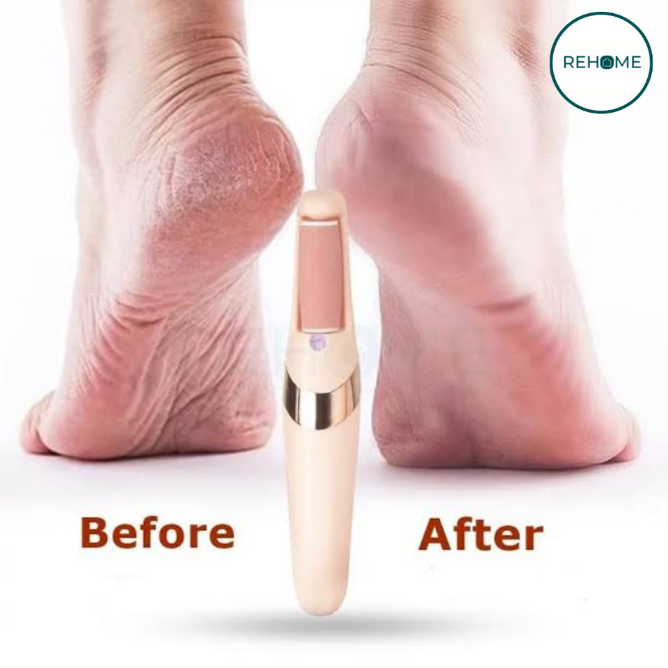 Flawless Pedi Callus Remover - (IMPORTED)