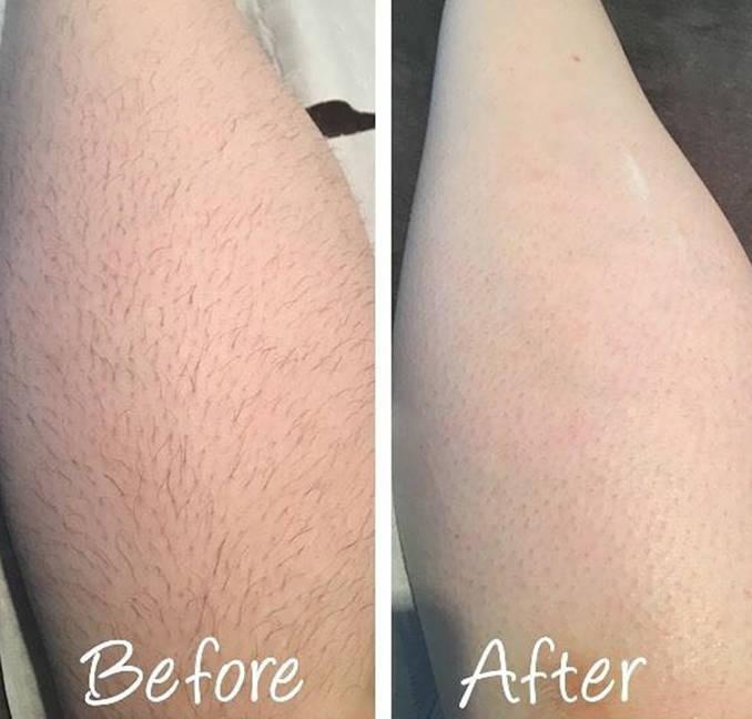 Hybertack Sugar Hair Removal Wax – Natural & Gentle Hair Removal